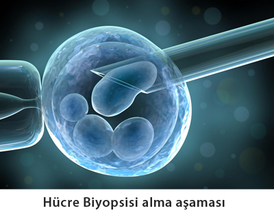 cinsiyet seçimi için hücre biyopsisi alınma