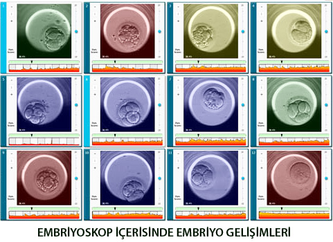 embriyoskop ile embriyo takibi