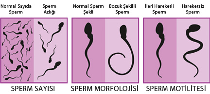 sperm bozuklukları