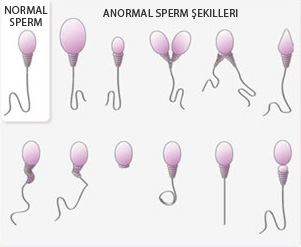 sperm yapıları